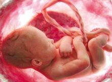 آیا غربالگری جنین عملا غیرممکن شد؟